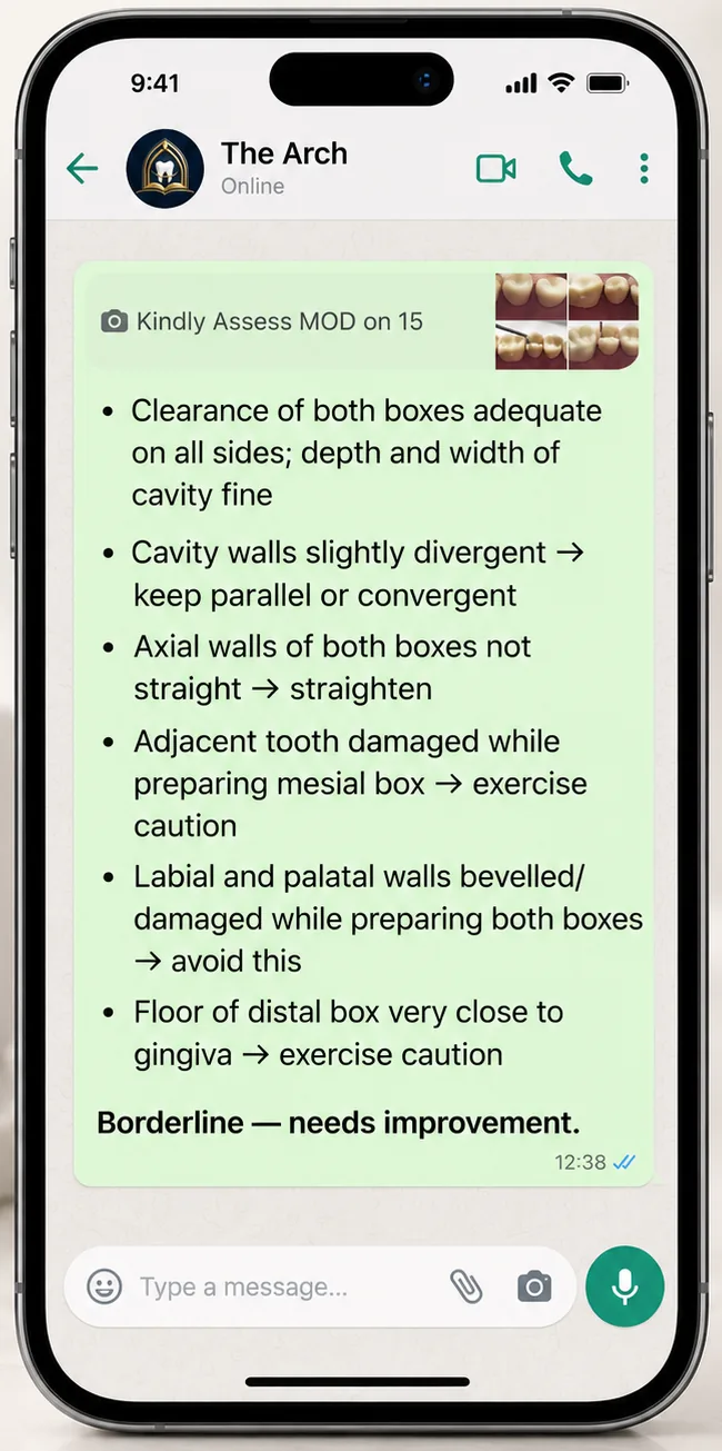 WhatsApp feedback on an MOD cavity on tooth 15: wall divergence, axial walls and the adjacent tooth, with the verdict Borderline, needs improvement